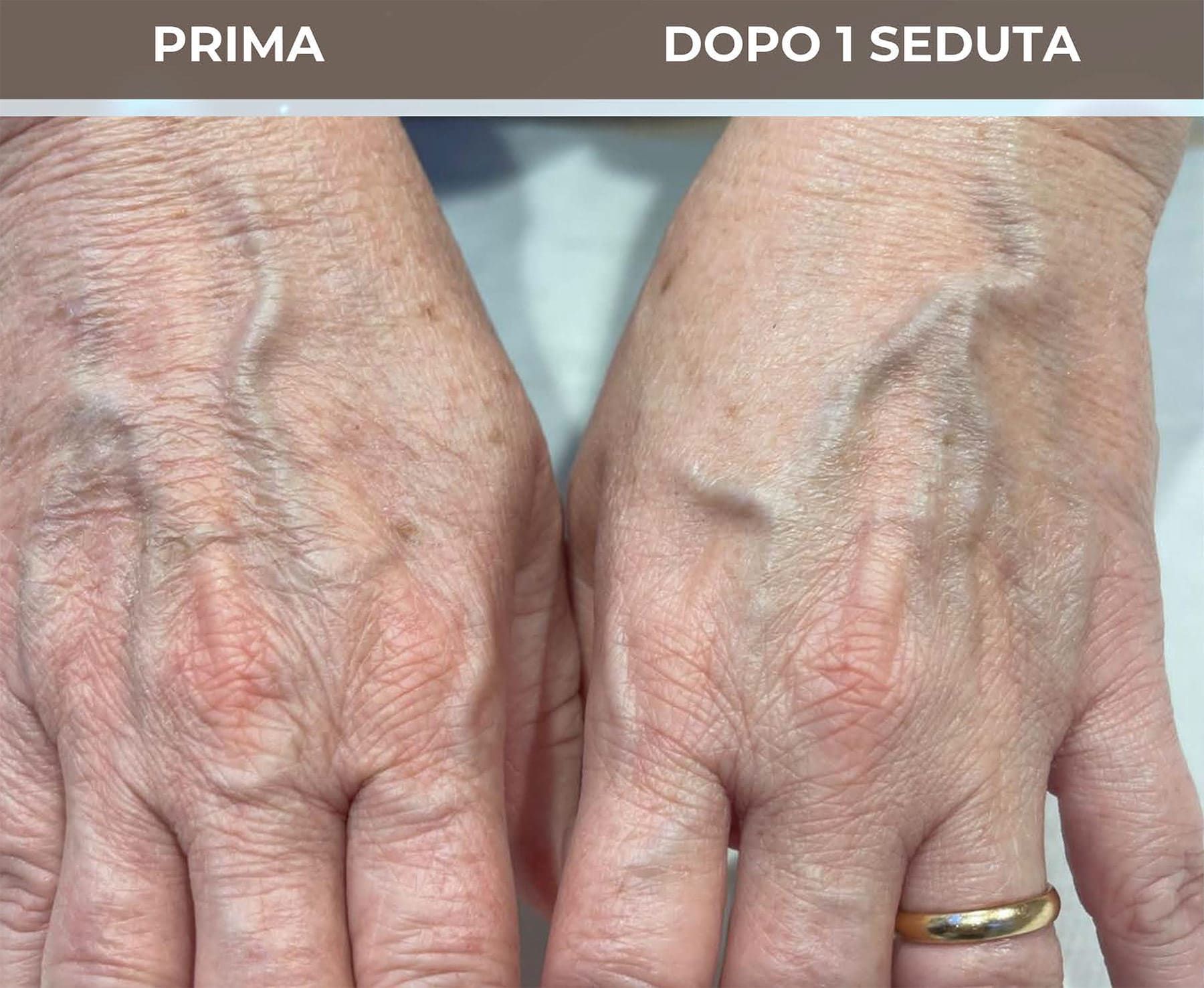 Trattamento skincare mani Pablo Gil Cagnè a Roma