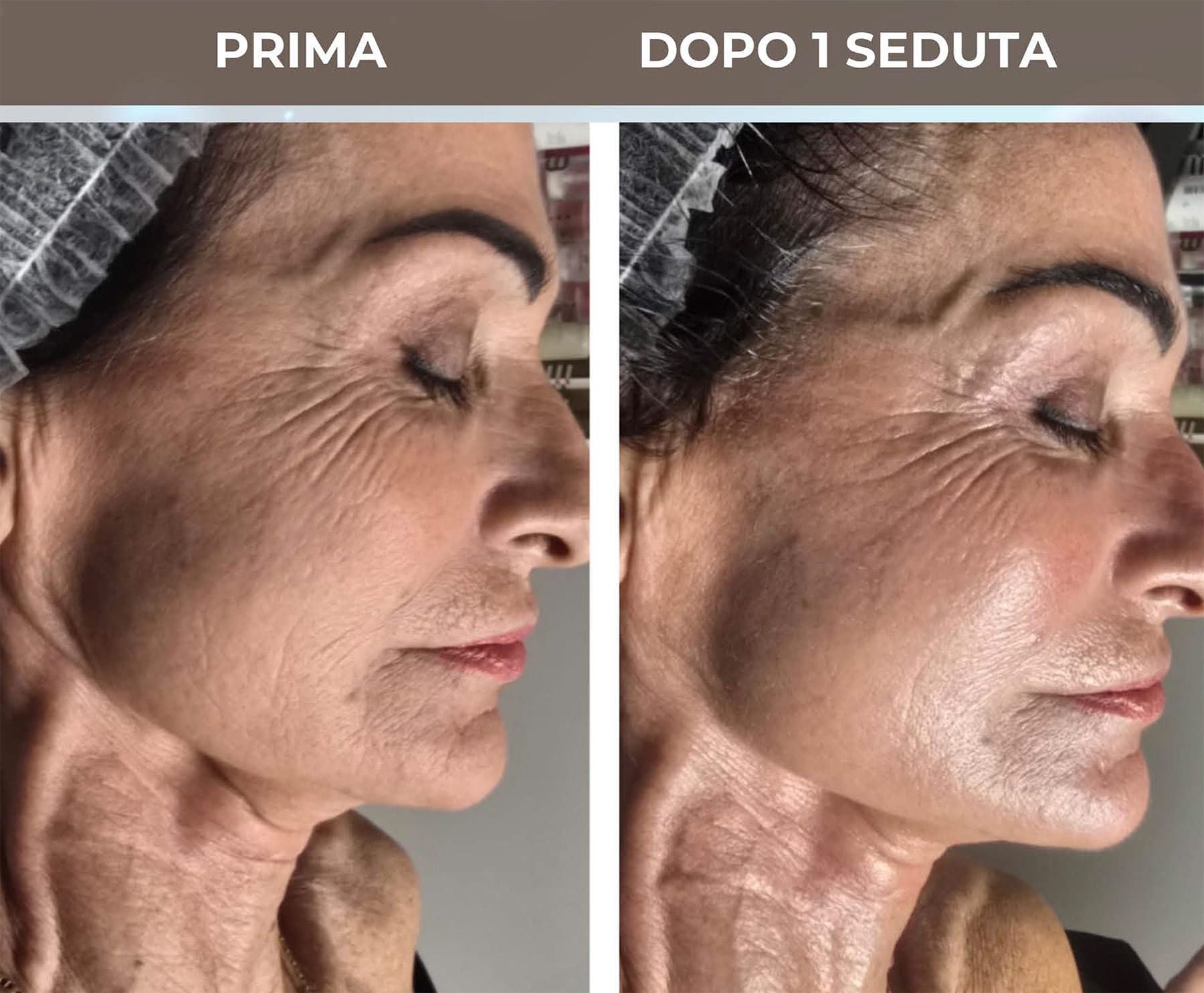 Trattamento viso ultra 50enni a Roma