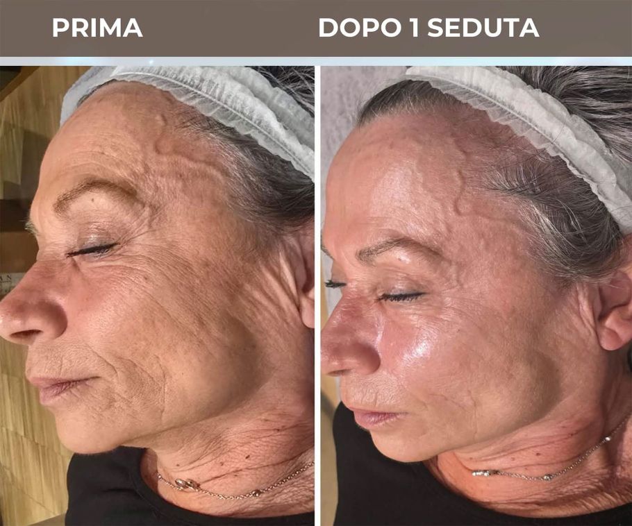 Trattamento Skincare viso Pablo Gil Cagne